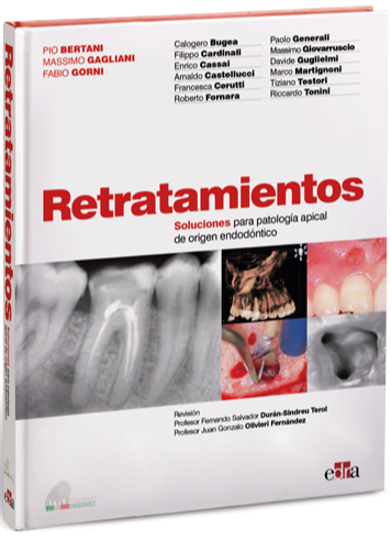 Retratamientos. Soluciones para patología apical de origen endodóntico